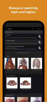 Télécharger Visible Body Suite Médecine pour Android Capture d'écran 6