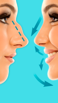 Télécharger Rhinoplastie : éditeur de nez Beauté pour Android Capture d'écran 4